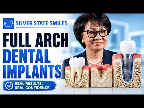 Jaw bone loss? Tired of Loose Dentures? Full Arch Dental Implants Explained #foreversmile