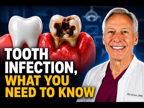 What Happens When You Ignore a Tooth Infection? | Dentist Explains #foreversmile #oralhealthtips